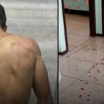 Criminoso invade casa, esfaqueia idoso e rouba dinheiro no Alto Vale